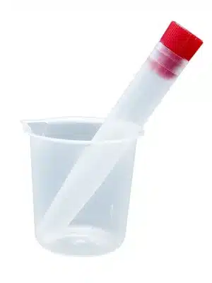 KIT P/COLETA DE URINA ESTERIL (BECKER + TUBO 12ML);J. PROLAB